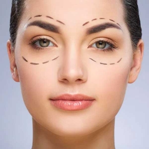 Blefaroplastia em foco